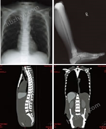 日本KYOTO KAGAKU PBU-50全身模体