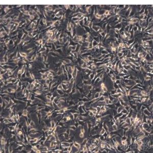 BT449小鼠黑色素瘤细胞B16-F10