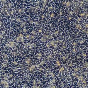 BT455小鼠皮下结缔组织细胞L Wnt 3A